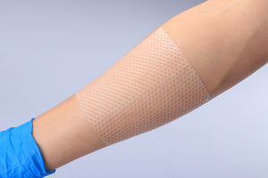 Protección de la piel Capa de contacto de silicona Iso/Ce aprobada por la FDA